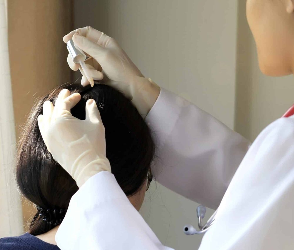 Who-should-get-scalp-treatments-scaled Who-should-get-scalp-treatments-scaled